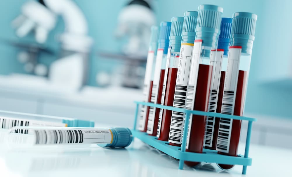 blood_samples