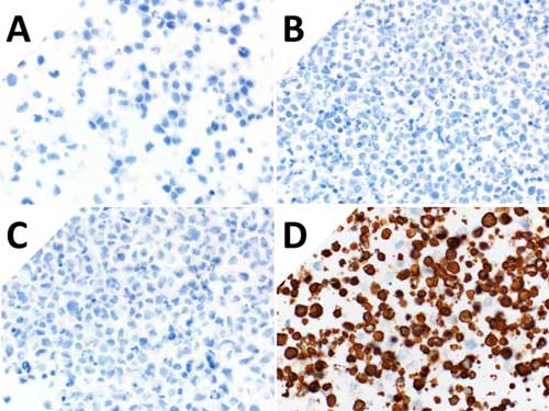 ihc-controls-analysis