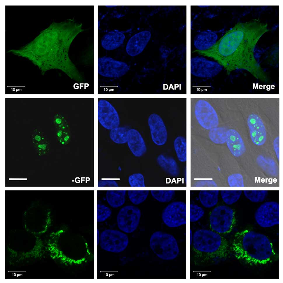 Cell images using a GFP filter, DAPI filter, and merged