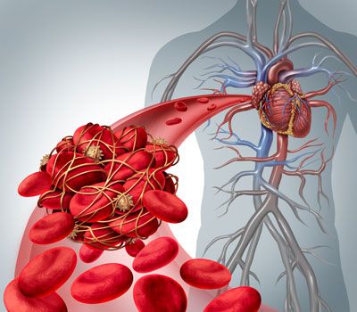 Thrombosis Proteins